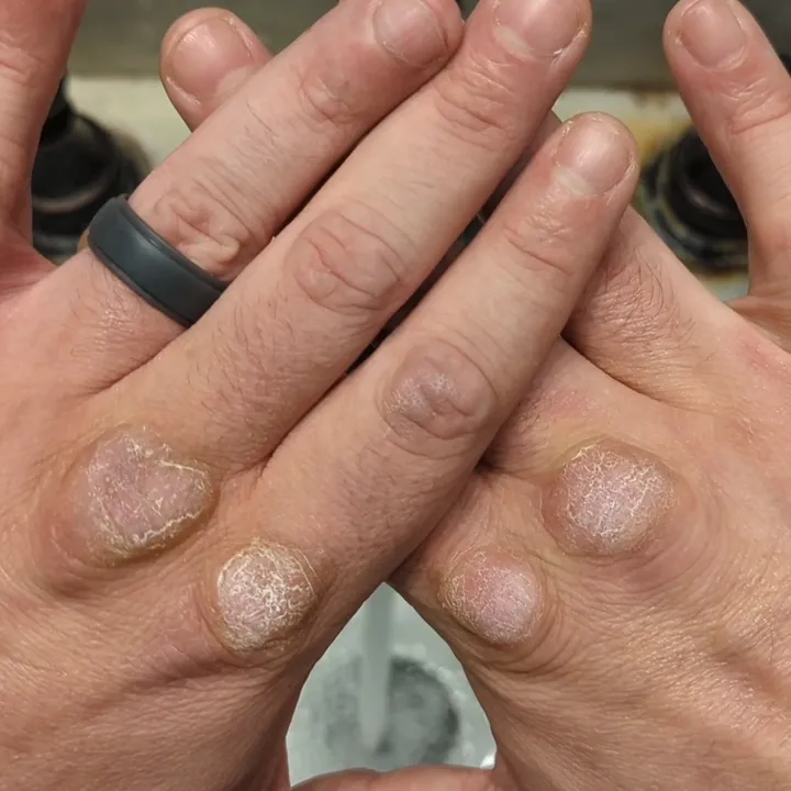 Fist Of The Dog Medicine