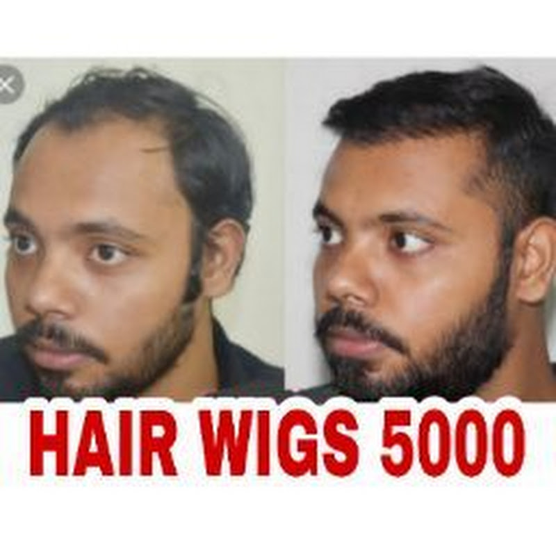 Hair wigs shop in lucknow