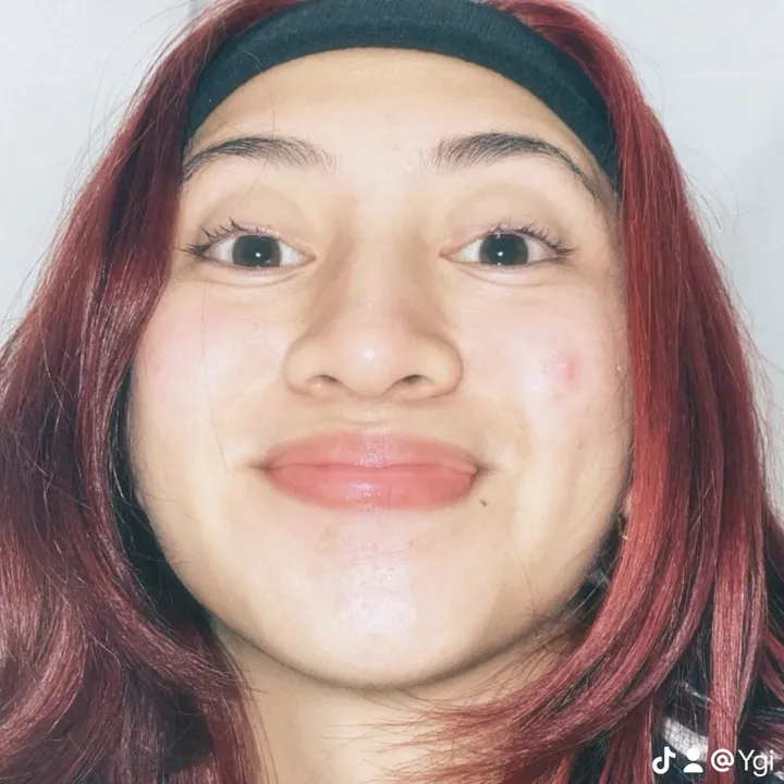Ygi