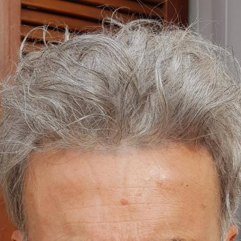 hair replacement system lace wig #short