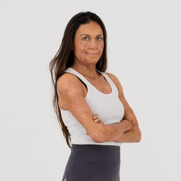 Turia Pitt
