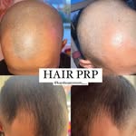 Advanced Skin, Hair Growth & Wellness Treatments