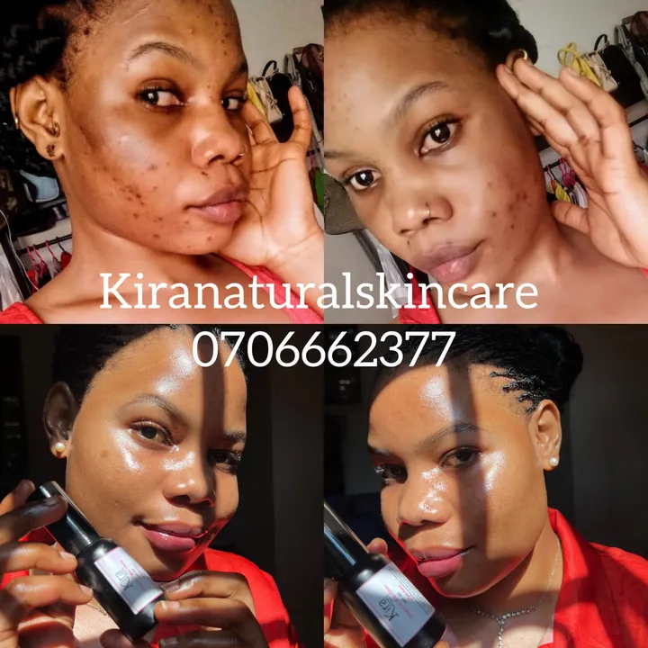 kirahnaturalskincare