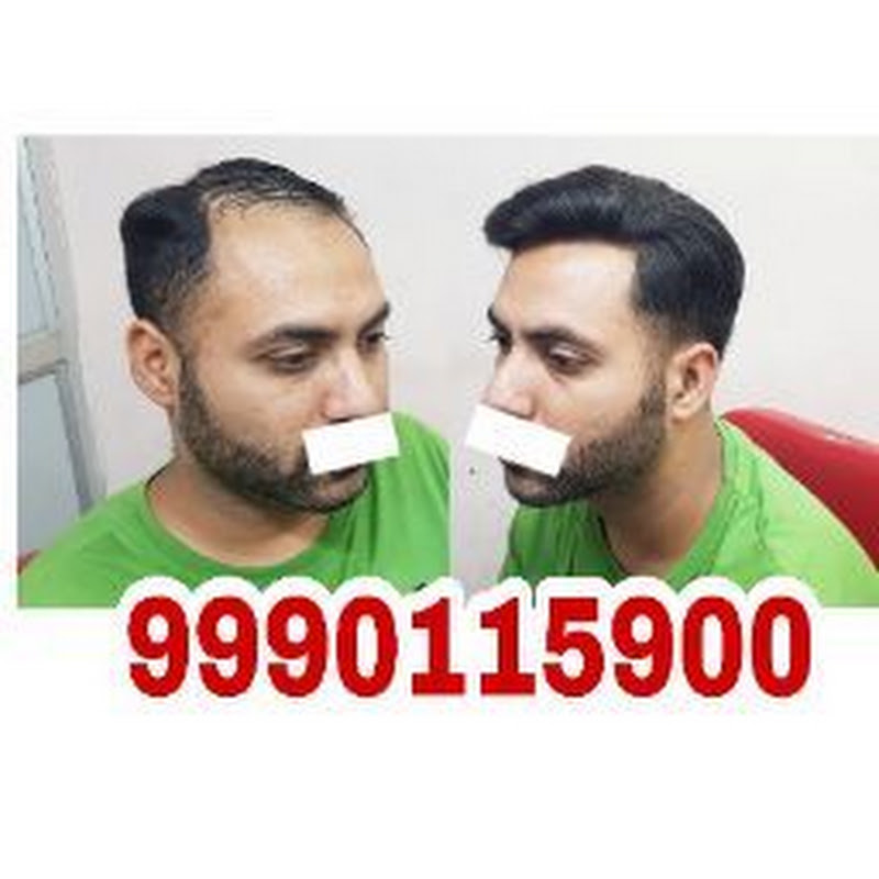 Hair Wigs In Delhi . Ritu Hair  Wigs