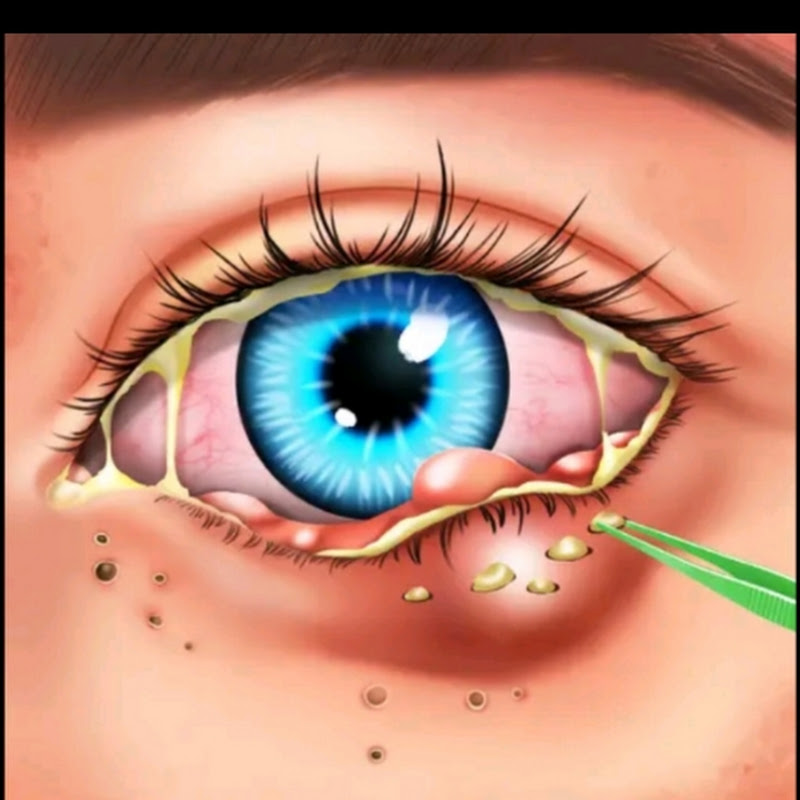 asmr tach