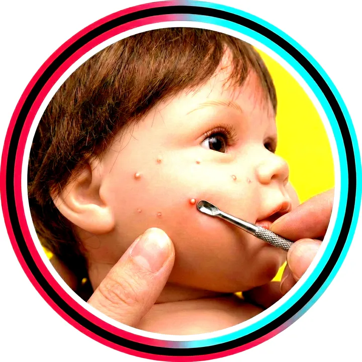 PIMPLE POPPING DOLL✨️🪡🔉)💉