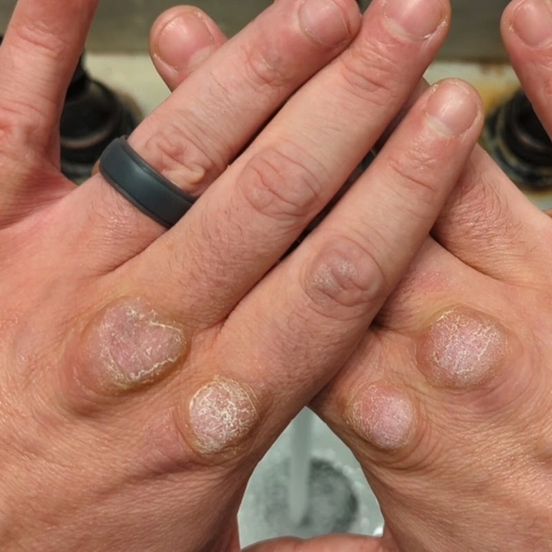 Fist Of The Dog Medicine