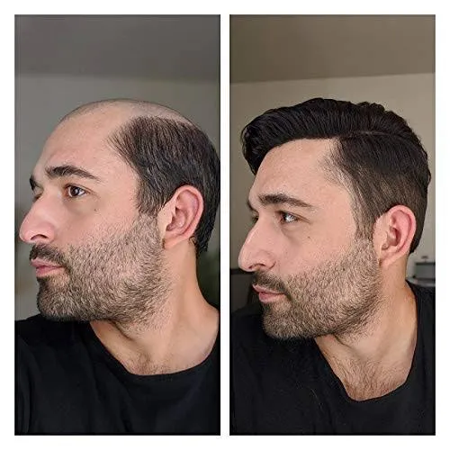 Hair 👴fixing 👨‍🦰💇