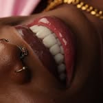 PORCELAIN VENEERS COLOMBIA