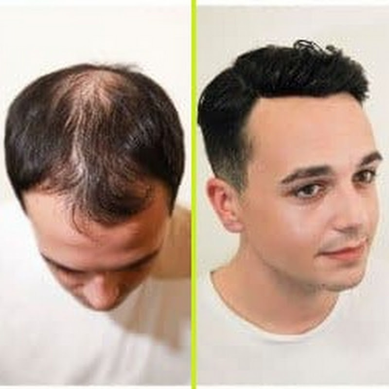  Hair Wig Shop in Delhi