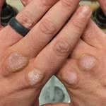 Fist Of The Dog Medicine
