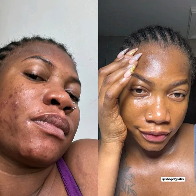 SKINCARE KING 🤴 ✨️ 💖 💛 😍