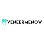 Veneermenow