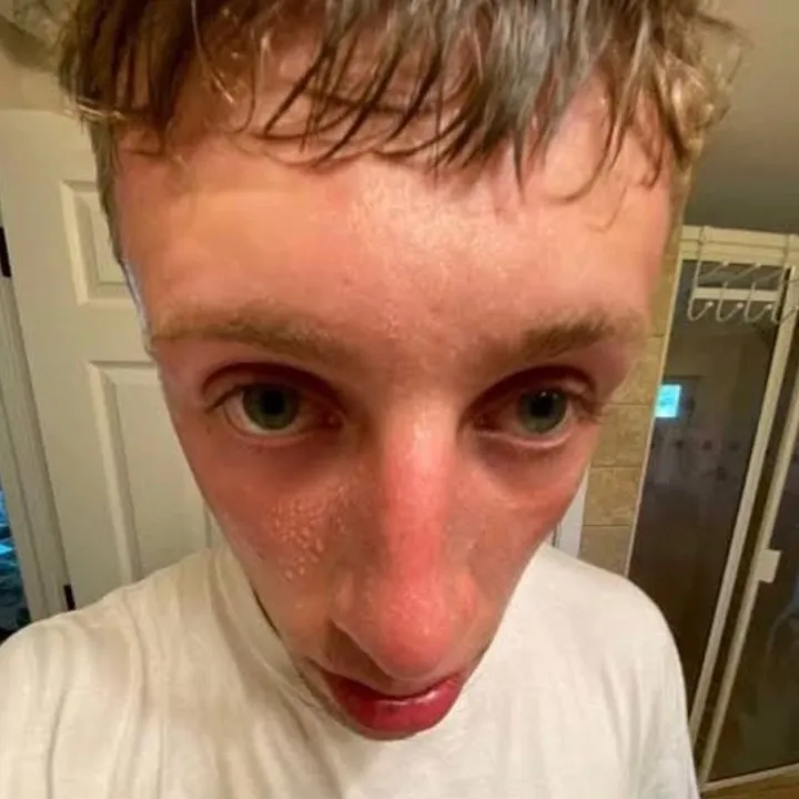 owen