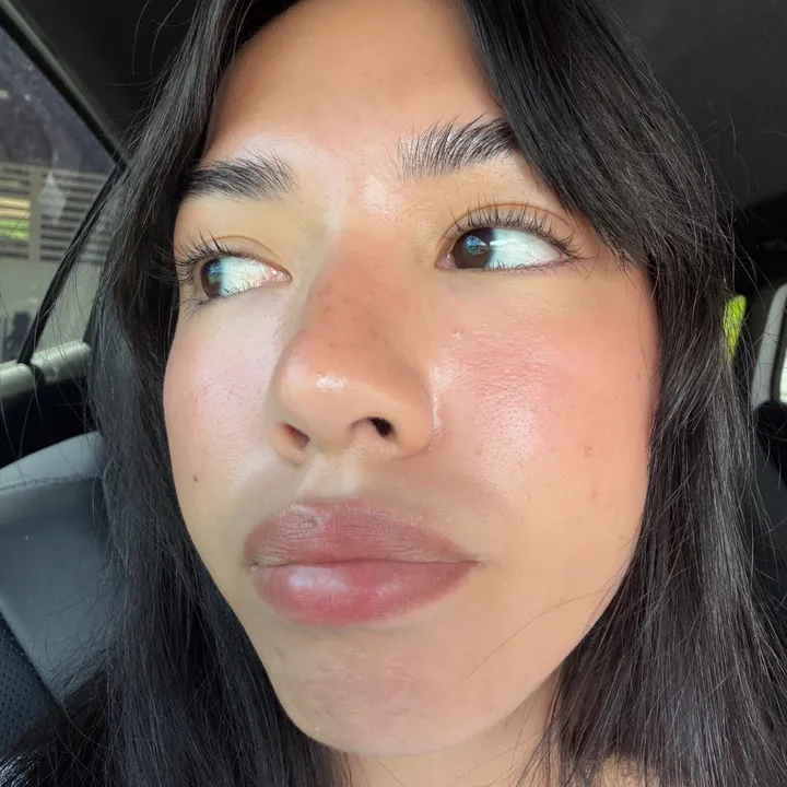 kyla