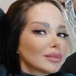 خرید مستقیم از کانادا🇨🇦و ترکیه🇹🇷و دبی