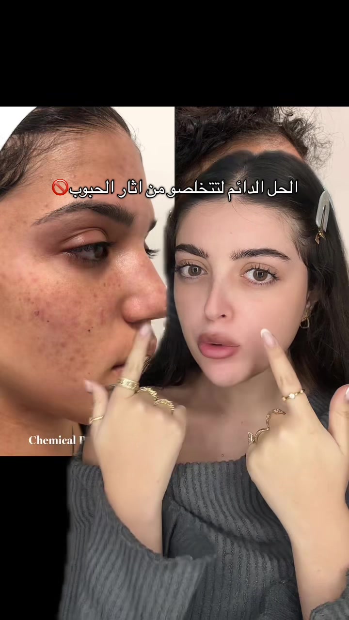 CC🌙