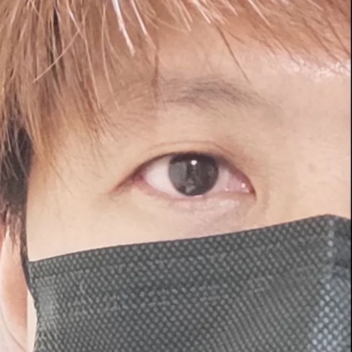 Vis C