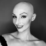 Felicia Alopecia