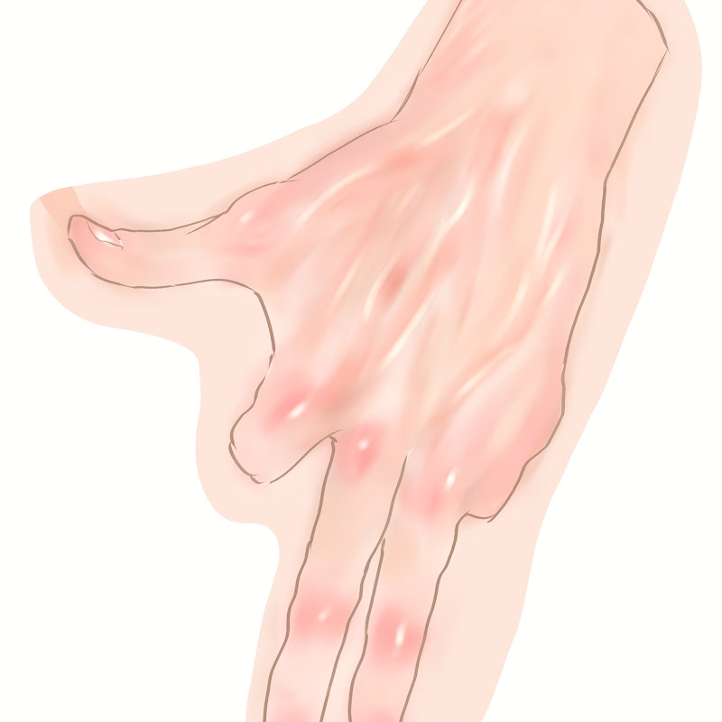 Adele Zaini